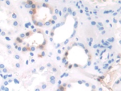 TAF1 Antibody - Western Blot; Sample: Recombinant TAF1, Human.