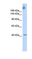 TAF1 Antibody - TAF1 antibody Western blot of Fetal liver lysate. This image was taken for the unconjugated form of this product. Other forms have not been tested.