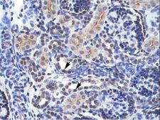TAF1 Antibody - TAF1 antibody ARP32473_P050-NP_620278-TAF1 (TAF1 RNA polymerase II, TATA box binding protein (TBP)-associated factor, 250kDa) Antibody was used in IHC to stain formalin-fixed, paraffin-embedded human kidney.  This image was taken for the unconjugated form of this product. Other forms have not been tested.