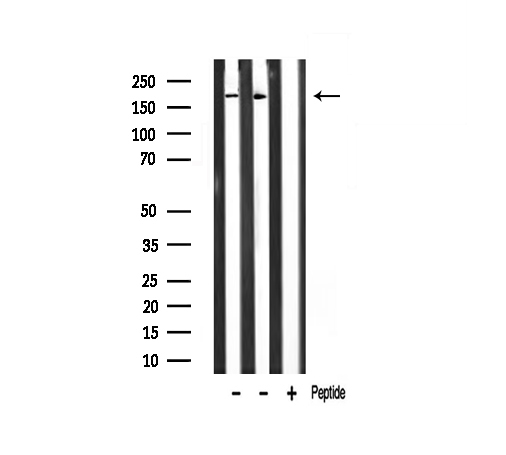 TAF1 Antibody - Western blot analysis of TAF1 antibody expression in mouse heart and rat muscle tissues lysates. The lane on the right is treated with the antigen-specific peptide.