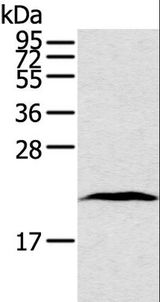 TAF10 Antibody - Western blot analysis of Human lung cancer tissue, using TAF10 Polyclonal Antibody at dilution of 1:400.