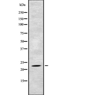 TAF10 Antibody - Western blot analysis of TAF10 using Jurkat whole cells lysates