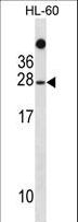 TAF11 Antibody - TAF11 Antibody western blot of HL-60 cell line lysates (35 ug/lane). The TAF11 antibody detected the TAF11 protein (arrow).