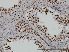TAF11 Antibody - Immunoperoxidase of monoclonal antibody to TAF11 on formalin-fixed paraffin-embedded human testis. [antibody concentration 3 ug/ml]