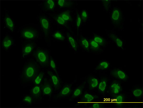 TAF11 Antibody - Immunofluorescence of monoclonal antibody to TAF11 on HeLa cell. [antibody concentration 10 ug/ml]