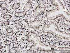 TAF11 Antibody - Immunoperoxidase of monoclonal antibody to TAF11 on formalin-fixed paraffin-embedded human small Intestine. [antibody concentration 1.2 ug/ml]