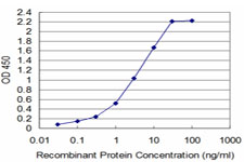 TAF11 Antibody - Detection limit for recombinant GST tagged TAF11 is approximately 0.1 ng/ml as a capture antibody.