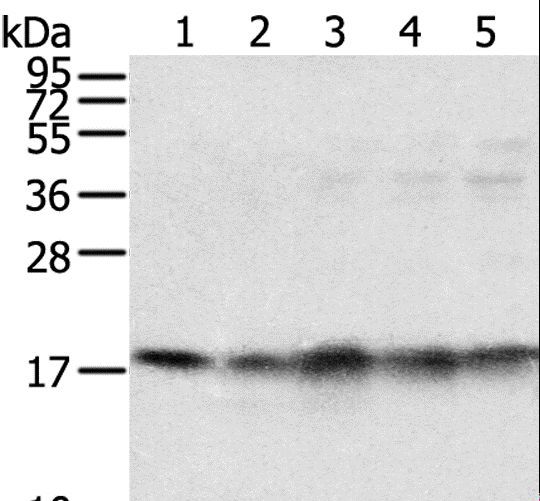 TAF11 Antibody - Western blot analysis of Mouse brain and heart tissue, Jurkat, K562 and HeLa cell, using TAF11 Polyclonal Antibody at dilution of 1:800.