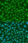 TAF11 Antibody - Immunofluorescence analysis of U2OS cells using TAF11 Polyclonal Antibody at dilution of 1:100.Blue: DAPI for nuclear staining.