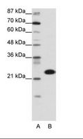 TAF11 Antibody - A: Marker, B: Transfected 293T Cell Lysate.  This image was taken for the unconjugated form of this product. Other forms have not been tested.