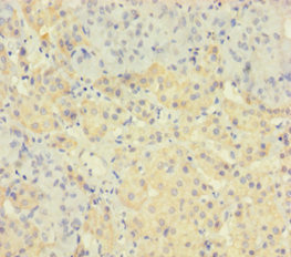 TAF12 Antibody - Immunohistochemistry of paraffin-embedded human adrenal gland tissue using TAF12 Antibody at dilution of 1:100