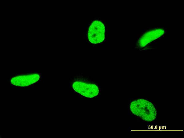 TAF12 Antibody - Immunofluorescence of monoclonal antibody to TAF12 on HeLa cell . [antibody concentration 10 ug/ml]