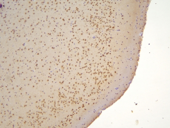 TAF12 Antibody - IHC staining of FFPE mouse brain with TAF12 antibody at 1ug/ml. HIER: boil tissue sections in pH6, 10mM citrate buffer, for 10-20 min and allow to cool before testing.
