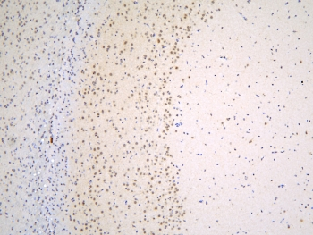 TAF12 Antibody - IHC staining of FFPE rat brain with TAF12 antibody at 1ug/ml. HIER: boil tissue sections in pH6, 10mM citrate buffer, for 10-20 min and allow to cool before testing.