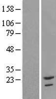 TAF12 Protein - Western validation with an anti-DDK antibody * L: Control HEK293 lysate R: Over-expression lysate