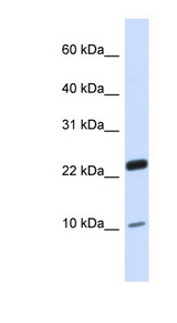 TAF13 Antibody - TAF13 antibody Western blot of Fetal Heart lysate. This image was taken for the unconjugated form of this product. Other forms have not been tested.