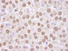 TAF15 Antibody - Detection of Human TAFII68 by Immunohistochemistry. Sample: FFPE section of human testicular seminoma. Antibody: Affinity purified rabbit anti-TAFII68 used at a dilution of 1:5000 (0.2 ug/ml). Detection: DAB.