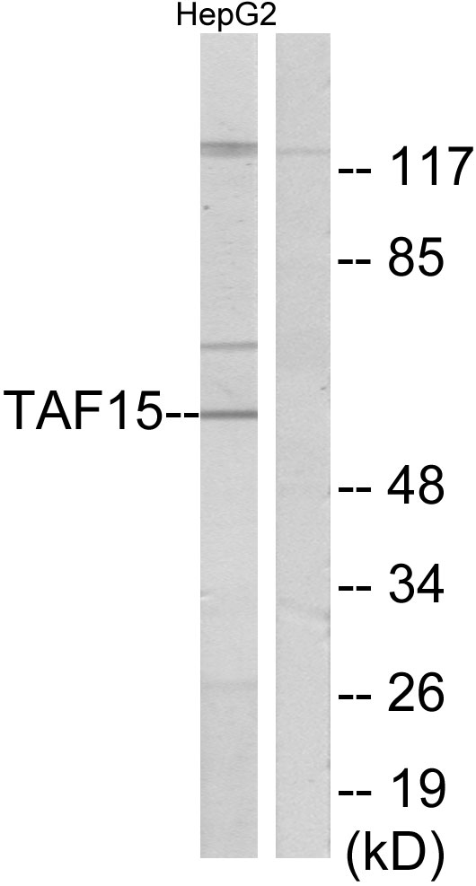 TAF15 Antibody - Western blot analysis of lysates from HepG2 cells, using TAF15 Antibody. The lane on the right is blocked with the synthesized peptide.