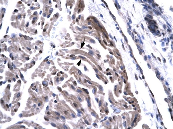 TAF15 Antibody - Human Skeletal Muscle.  This image was taken for the unconjugated form of this product. Other forms have not been tested.