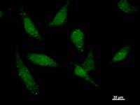 TAF15 Antibody - Immunostaining analysis in HeLa cells. HeLa cells were fixed with 4% paraformaldehyde and permeabilized with 0.1% Triton X-100 in PBS. The cells were immunostained with anti-TAF15 mAb.