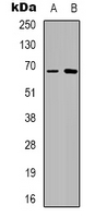 TAF15 Antibody - Western blot analysis of TAF15 expression in HeLa (A); HEK293T (B) whole cell lysates.