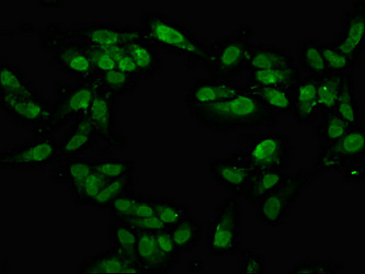 TAF15 Antibody - Immunofluorescence staining of Hela cells at a dilution of 1:100, counter-stained with DAPI. The cells were fixed in 4% formaldehyde, permeabilized using 0.2% Triton X-100 and blocked in 10% normal Goat Serum. The cells were then incubated with the antibody overnight at 4 °C.The secondary antibody was Alexa Fluor 488-congugated AffiniPure Goat Anti-Rabbit IgG (H+L) .