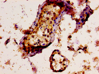 TAF15 Antibody - Immunohistochemistry image at a dilution of 1:300 and staining in paraffin-embedded human testis tissue performed on a Leica BondTM system. After dewaxing and hydration, antigen retrieval was mediated by high pressure in a citrate buffer (pH 6.0) . Section was blocked with 10% normal goat serum 30min at RT. Then primary antibody (1% BSA) was incubated at 4 °C overnight. The primary is detected by a biotinylated secondary antibody and visualized using an HRP conjugated SP system.