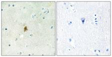 TAF15 Antibody - Peptide - + Immunohistochemistry analysis of paraffin-embedded human brain tissue using TAF15 antibody.