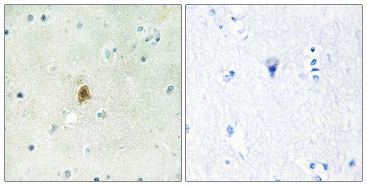 TAF15 Antibody - Peptide - + Immunohistochemistry analysis of paraffin-embedded human brain tissue using TAF15 antibody.