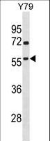 TAF1A Antibody - TAF1A Antibody western blot of Y79 cell line lysates (35 ug/lane). The TAF1A antibody detected the TAF1A protein (arrow).