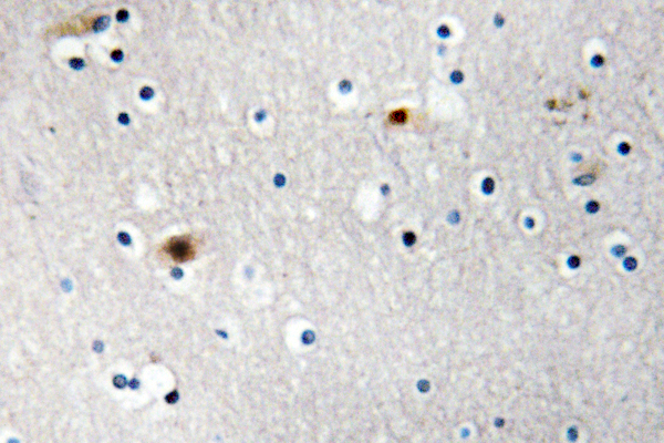 TAF1A Antibody - IHC of TAF I p48 (R318) pAb in paraffin-embedded human brain carcinoma tissue.