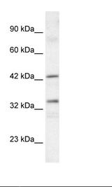 TAF1A Antibody - Jurkat Cell Lysate.  This image was taken for the unconjugated form of this product. Other forms have not been tested.