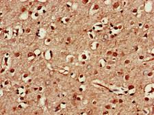 TAF1A Antibody - Immunohistochemistry of paraffin-embedded human brain tissue at dilution of 1:100