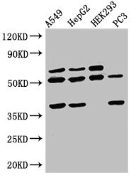 TAF1A Antibody - Western Blot Positive WB detected in:A549 whole cell lysate,HepG2 whole cell lysate,HEK293 whole cell lysate,PC3 whole cell lysate All Lanes:TAF1A antibody at 2.5µg/ml Secondary Goat polyclonal to rabbit IgG at 1/50000 dilution Predicted band size: 53,40 KDa Observed band size: 53,40 KDa