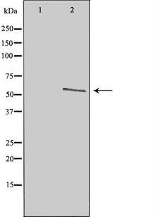 TAF1A Antibody - Western blot analysis of extracts of HeLa cells using TAF1A antibody. The lane on the left is treated with the antigen-specific peptide.