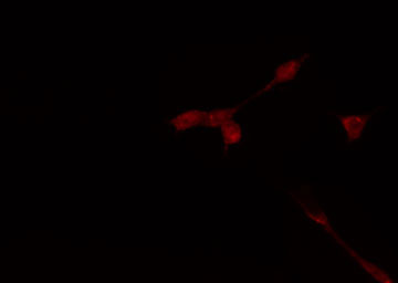 TAF1A Antibody - Staining HeLa cells by IF/ICC. The samples were fixed with PFA and permeabilized in 0.1% Triton X-100, then blocked in 10% serum for 45 min at 25°C. The primary antibody was diluted at 1:200 and incubated with the sample for 1 hour at 37°C. An Alexa Fluor 594 conjugated goat anti-rabbit IgG (H+L) antibody, diluted at 1/600, was used as secondary antibody.
