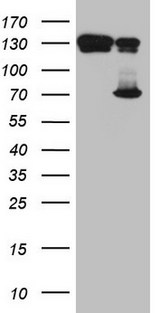 TAF1B Antibody - HEK293T cells were transfected with the pCMV6-ENTRY control. (Left lane) or pCMV6-ENTRY TAF1B. (Right lane) cDNA for 48 hrs and lysed. Equivalent amounts of cell lysates. (5 ug per lane) were separated by SDS-PAGE and immunoblotted with anti-TAF1B. (1:2000)