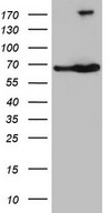 TAF1B Antibody - HEK293T cells were transfected with the pCMV6-ENTRY control. (Left lane) or pCMV6-ENTRY TAF1B. (Right lane) cDNA for 48 hrs and lysed. Equivalent amounts of cell lysates. (5 ug per lane) were separated by SDS-PAGE and immunoblotted with anti-TAF1B. (1:2000)