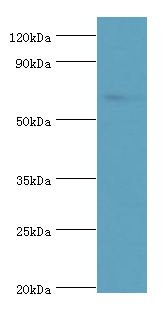 TAF1B Antibody - Western blot. All lanes: TATA box-binding protein-associated factor RNA polymerase I subunit B antibody at 4 ug/ml+HeLa whole cell lysate. Secondary antibody: Goat polyclonal to rabbit at 1:10000 dilution. Predicted band size: 69 kDa. Observed band size: 69 kDa Immunohistochemistry.
