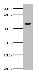 TAF1B Antibody - Western blot All lanes: TATA box-binding protein-associated factor RNA polymerase I subunit B antibody at 4µg/ml + Hela whole cell lysate Secondary Goat polyclonal to rabbit IgG at 1/10000 dilution Predicted band size: 69, 61, 40 kDa Observed band size: 69 kDa