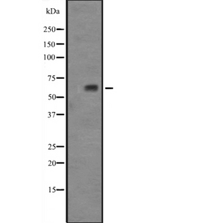 TAF1B Antibody - Western blot analysis of TAF1B expression in HeLa cells lysate. The lane on the left is treated with the antigen-specific peptide.
