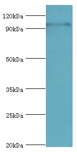 TAF1C Antibody - Western blot. All lanes: TAF1C antibody at 2 ug/ml+293T whole cell lysate. Secondary antibody: Goat polyclonal to rabbit at 1:10000 dilution. Predicted band size: 95 kDa. Observed band size: 95 kDa.