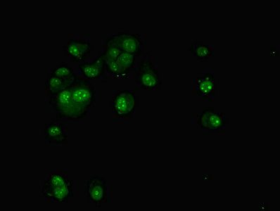 TAF1C Antibody - Immunofluorescent analysis of MCF-7 cells using TAF1C Antibody at dilution of 1:100 and Alexa Fluor 488-congugated AffiniPure Goat Anti-Rabbit IgG(H+L)