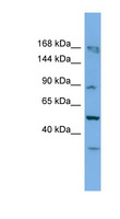 TAF1C Antibody - TAF1C antibody Western blot of Mouse Uterus lysate. This image was taken for the unconjugated form of this product. Other forms have not been tested.
