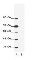 TAF1C Antibody - A: Marker, B: Jurkat Cell Lysate.  This image was taken for the unconjugated form of this product. Other forms have not been tested.
