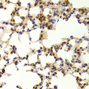 TAF1C Antibody - Immunohistochemistry of paraffin-embedded Mouse lung tissue.