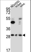 TAF1D Antibody - TAF1D Antibody western blot of NCI-H292,Jurkat cell line and mouse liver lysates (15 ug/lane). The TAF1D antibody detected the TAF1D protein (arrow).