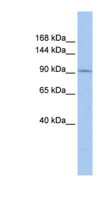TAF3 Antibody - TAF3 antibody Western blot of HepG2 cell lysate. This image was taken for the unconjugated form of this product. Other forms have not been tested.