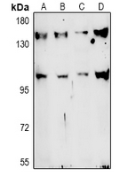 TAF3 Antibody - Western blot analysis of TAF3 expression in SP20 (A), C6 (B), MCF7 (C), K562 (D) whole cell lysates.