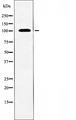 TAF3 Antibody - Western blot analysis of extracts of K562 cells using TAF3 antibody.